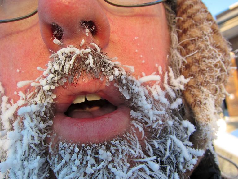 frozen beard