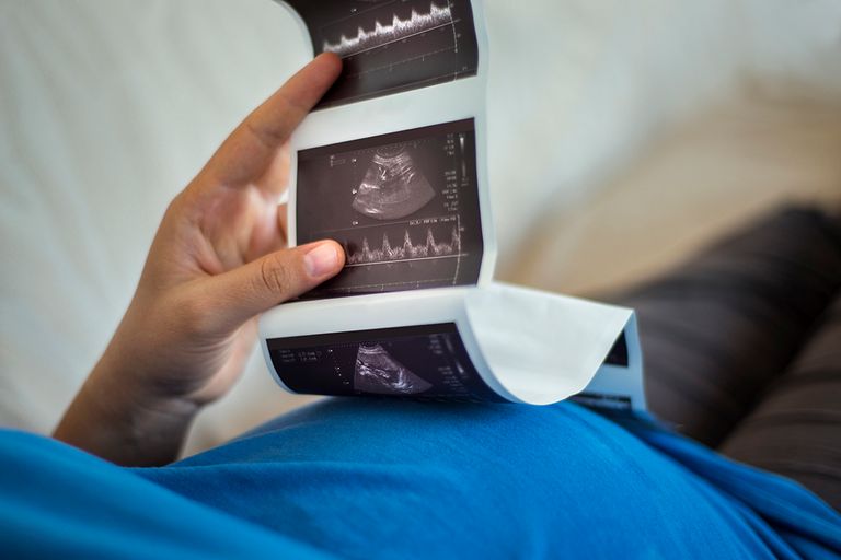 https://www.gettyimages.com/detail/photo/close-up-view-of-a-mother-looking-at-ultrasound-royalty-free-image/804830756?phrase=ultrasound+triplets